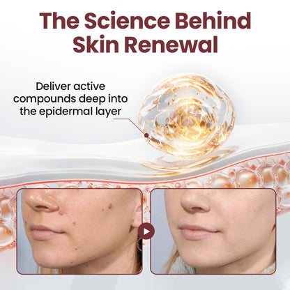 ODALIT™KeraErase Dual-Action Renewal Cream