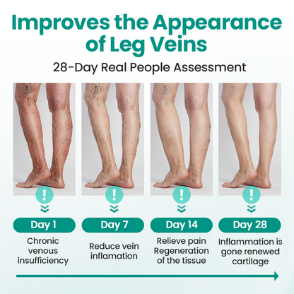 LBMLBM™ LegRenew Varicose Veins Patch