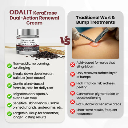 ODALIT™KeraErase Dual-Action Renewal Cream